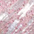 Champagne Pink