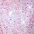 Pink Ab
